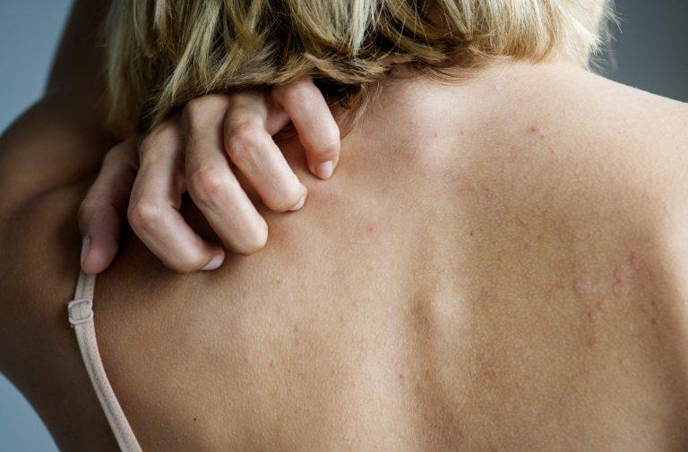 Why Does Our Skin Itch? Mechanisms and Significance of Itching for the Body